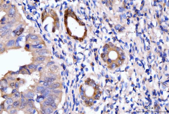 Anti-HMGCS1 Antibody