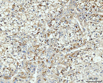 Anti-HMGCS1 Antibody