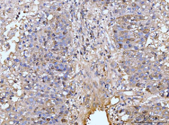 Anti-HMGCS1 Antibody