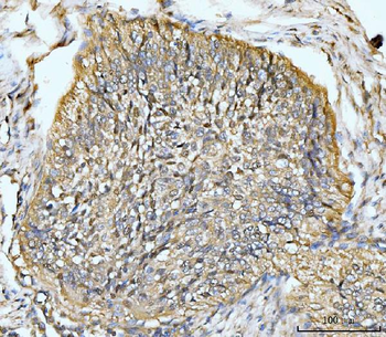 Anti-HMGCS1 Antibody