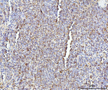 Anti-IL-17A/Il17a Antibody