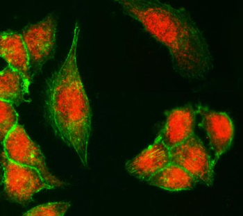 Anti-UTX/KDM6A Antibody