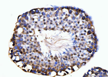 Anti-KIFC1 Antibody