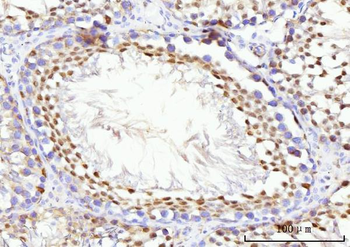 Anti-KIFC1 Antibody