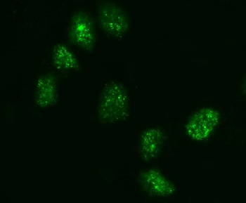 Anti-KIFC1 Antibody