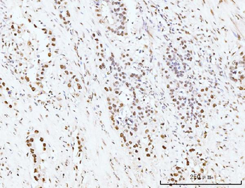 Anti-KIFC1 Antibody