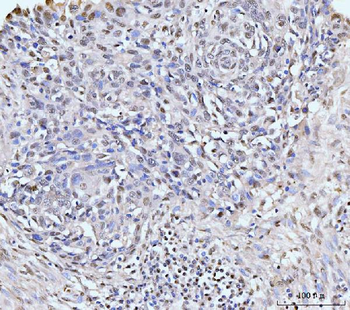 Anti-KIFC1 Antibody