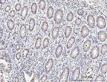 Anti-KIFC1 Antibody