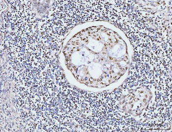 Anti-KIFC1 Antibody