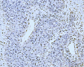 Anti-KIFC1 Antibody