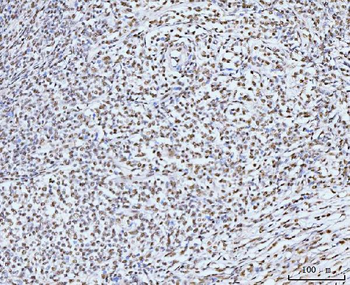 Anti-KIFC1 Antibody