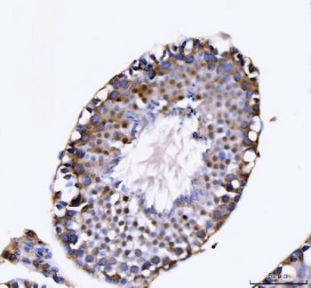 Anti-KIFC1 Antibody