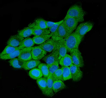 Anti-LARP4B Antibody