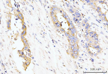 Anti-LARP4B Antibody