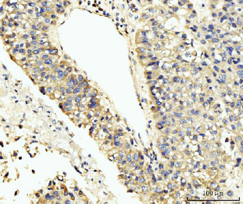 Anti-LARP4B Antibody