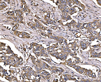 Anti-LSR Antibody