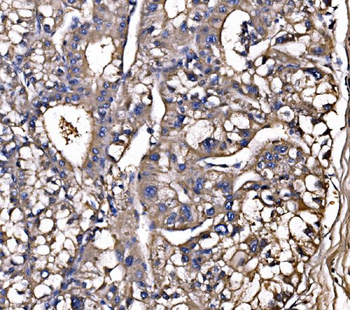 Anti-LSR Antibody