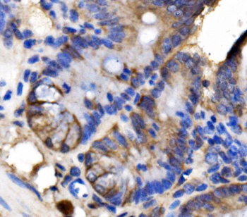 Anti-LSR Antibody