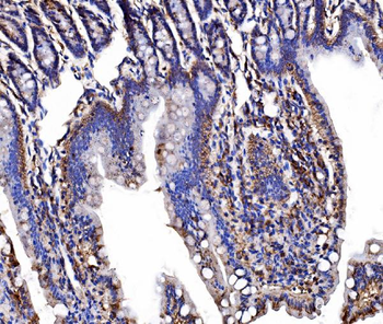 Anti-LSR Antibody