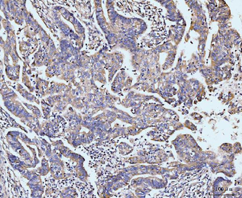 Anti-MAP4K1/HPK1 Antibody