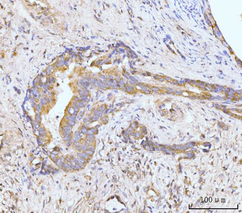 Anti-MAP4K1/HPK1 Antibody