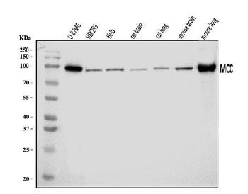 Anti-MCC Antibody