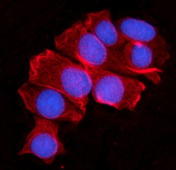 Anti-MOV10 Antibody