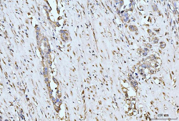 Anti-MOV10 Antibody