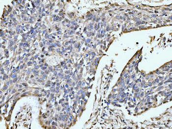 Anti-MOV10 Antibody