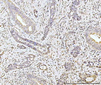 Anti-MOV10 Antibody
