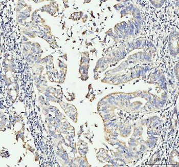 Anti-MOV10 Antibody