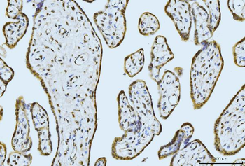 Anti-MOV10 Antibody