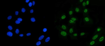 Anti-MSH6 Antibody