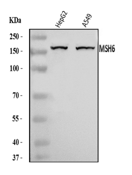 Anti-MSH6 Antibody