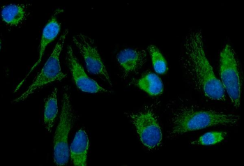 Anti-MT-ND5 Antibody