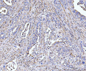 Anti-MT-ND5 Antibody