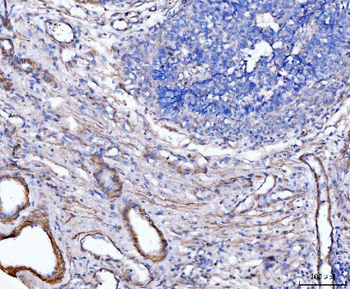 Anti-MT-ND5 Antibody