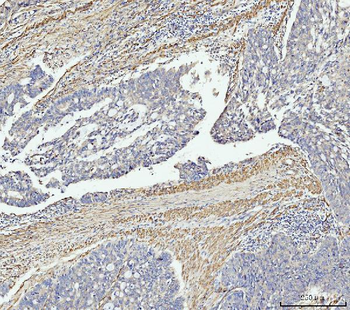 Anti-MT-ND5 Antibody