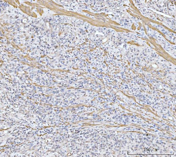 Anti-MT-ND5 Antibody