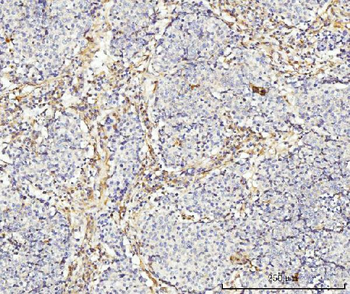 Anti-MT-ND5 Antibody