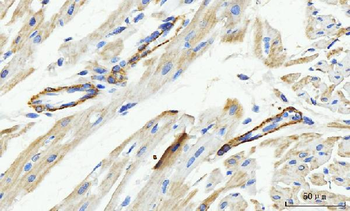 Anti-MT-ND5 Antibody