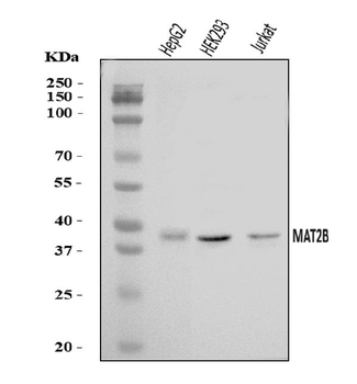Anti-MAT2B/TGR Antibody