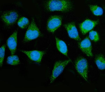 Anti-MTMR2 Antibody