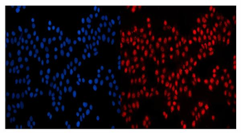 Anti-GP210/NUP210 Antibody