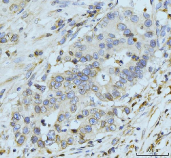 Anti-GP210/NUP210 Antibody