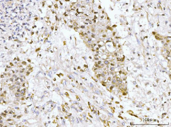 Anti-GP210/NUP210 Antibody