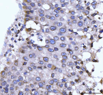 Anti-GP210/NUP210 Antibody
