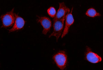 Anti-PDE4DIP Antibody