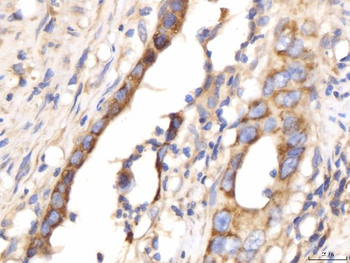 Anti-PDE4DIP Antibody