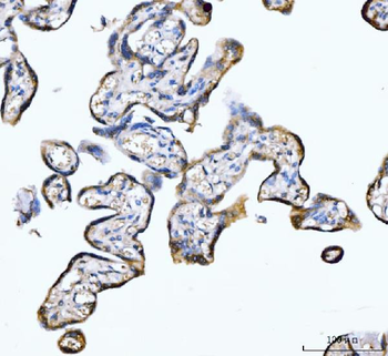 Anti-PDE4DIP Antibody